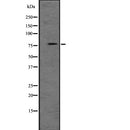 Western blot analysis of PRKG1 expression in  NIH3T3 whole cell lysate ;,The lane on the left is treated with the antigen-specific peptide.