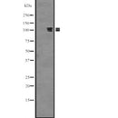 Western blot analysis of PKN3 expression in  Hela cell lysate,The lane on the left is treated with the antigen-specific peptide.