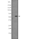 Western blot analysis of SGK3 expression in  U-87 MG whole cell lysate ,The lane on the left is treated with the antigen-specific peptide.