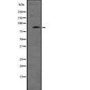Western blot analysis of SNRK expression in A431 whole cell lysate ,The lane on the left is treated with the antigen-specific peptide.