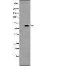 DF2682 at 1/100 staining Human breast cancer tissue by IHC-P. The sample was formaldehyde fixed and a heat mediated antigen retrieval step in citrate buffer was performed. The sample was then blocked and incubated with the antibody for 1.5 hours at 22¡ãC. An HRP conjugated goat anti-rabbit antibody was used as the secondary