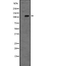 Western blot analysis of extracts from Hela, using TAOK2 Antibody. Lane 1 was treated with the blocking peptide.