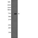 Western blot analysis of TNK1 expression in  RPMI-8226 cell lysate ,The lane on the left is treated with the antigen-specific peptide.