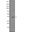 Western blot analysis of extracts from Mouse lung, using TRIO Antibody. The lane on the left was treated with blocking peptide.