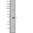 Western blot analysis of extracts from mouse brain and mouse heart and mouse spleen, using TSSK3 Antibody.