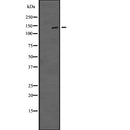 Western blot analysis of TTBK1 expression in  Jurkat cell lysate ;,The lane on the left is treated with the antigen-specific peptide.