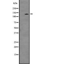 Western blot analysis of TTBK2 expression in  Mouse thymus lysate ;,The lane on the left is treated with the antigen-specific peptide.