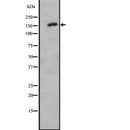 DF2689 at 1/100 staining Mouse liver tissue by IHC-P. The sample was formaldehyde fixed and a heat mediated antigen retrieval step in citrate buffer was performed. The sample was then blocked and incubated with the antibody for 1.5 hours at 22¡ãC. An HRP conjugated goat anti-rabbit antibody was used as the secondary
