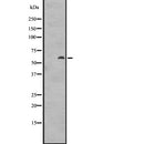 DF2690 at 1/100 staining Mouse liver tissue by IHC-P. The sample was formaldehyde fixed and a heat mediated antigen retrieval step in citrate buffer was performed. The sample was then blocked and incubated with the antibody for 1.5 hours at 22¡ãC. An HRP conjugated goat anti-rabbit antibody was used as the secondary