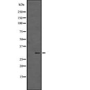 Western blot analysis of extracts from rta brain, rat spleen , using SGK494 Antibody.