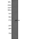 Western blot analysis of TRIB2 expression in A431 whole cell lysate ,The lane on the left is treated with the antigen-specific peptide.