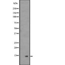 Western blot analysis of Histone H2B expression in A431 whole cell lysate ,The lane on the left is treated with the antigen-specific peptide.