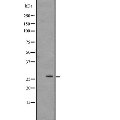DF2694 at 1/100 staining Human brain cancer tissue by IHC-P. The sample was formaldehyde fixed and a heat mediated antigen retrieval step in citrate buffer was performed. The sample was then blocked and incubated with the antibody for 1.5 hours at 22¡ãC. An HRP conjugated goat anti-rabbit antibody was used as the secondary