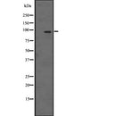 Western blot analysis of ATG9A expression in Jurkat cell lysate,The lane on the left is treated with the antigen-specific peptide.