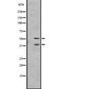 Western blot analysis of IL27A expression in A431 whole cell lysate ,The lane on the left is treated with the antigen-specific peptide.