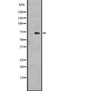 Western blot analysis of HSPA1A expression in  Hela cell lysate,The lane on the left is treated with the antigen-specific peptide.