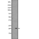 DF2701 at 1/100 staining Human Melanoma tissue by IHC-P. The sample was formaldehyde fixed and a heat mediated antigen retrieval step in citrate buffer was performed. The sample was then blocked and incubated with the antibody for 1.5 hours at 22¡ãC. An HRP conjugated goat anti-rabbit antibody was used as the secondary