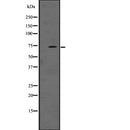 Western blot analysis of LRRN1 expression in A431 whole cell lysate ,The lane on the left is treated with the antigen-specific peptide.