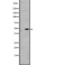 DF2706 at 1/100 staining human brain tissue sections by IHC-P. The tissue was formaldehyde fixed and a heat mediated antigen retrieval step in citrate buffer was performed. The tissue was then blocked and incubated with the antibody for 1.5 hours at 22¡ãC. An HRP conjugated goat anti-rabbit antibody was used as the secondary