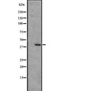 DF2714 at 1/100 staining Mouse lung tissue by IHC-P. The sample was formaldehyde fixed and a heat mediated antigen retrieval step in citrate buffer was performed. The sample was then blocked and incubated with the antibody for 1.5 hours at 22¡ãC. An HRP conjugated goat anti-rabbit antibody was used as the secondary