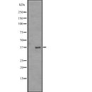 Western blot analysis of extracts from rat brain, using OR51A1P Antibody. Lane 1 was treated with the blocking peptide.