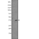 Western blot analysis of OR52Z1P expression in  K562 cell line lysates ;,The lane on the left is treated with the antigen-specific peptide.