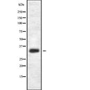 Western blot analysis of HOR5'Beta13 expression in HEK293 cells ,The lane on the left is treated with the antigen-specific peptide.