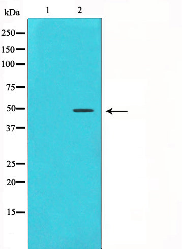 Western blot analysis on HeLa cell lysate using Cyclin E1 Antibody,The lane on the left is treated with the antigen-specific peptide.