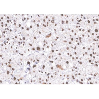 AF0144 at 1/200 staining human Liver tissue sections by IHC-P. The tissue was formaldehyde fixed and a heat mediated antigen retrieval step in citrate buffer was performed. The tissue was then blocked and incubated with the antibody for 1.5 hours at 22¡ãC. An HRP conjugated goat anti-rabbit antibody was used as the secondary