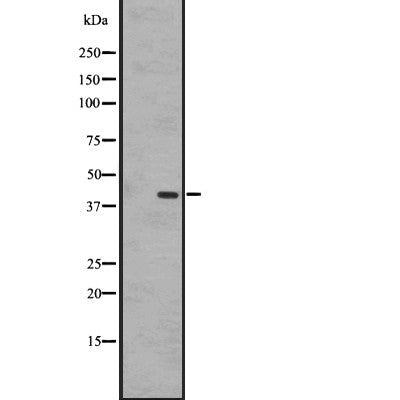 DF2776 at 1/100 staining Mouse lung tissue by IHC-P. The sample was formaldehyde fixed and a heat mediated antigen retrieval step in citrate buffer was performed. The sample was then blocked and incubated with the antibody for 1.5 hours at 22¡ãC. An HRP conjugated goat anti-rabbit antibody was used as the secondary