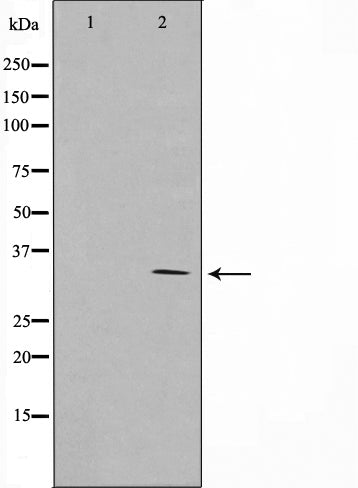 Western blot analysis on Jurkat cell lysate using Cyclin G Antibody,The lane on the left is treated with the antigen-specific peptide.