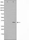 Western blot analysis on Jurkat cell lysate using Cyclin G Antibody,The lane on the left is treated with the antigen-specific peptide.