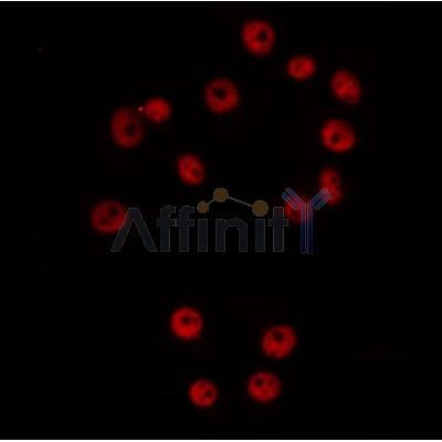 AF0145 staining Hela by IF/ICC. The sample were fixed with PFA and permeabilized in 0.1% Triton X-100,then blocked in 10% serum for 45 minutes at 25¡ãC. The primary antibody was diluted at 1/200 and incubated with the sample for 1 hour at 37¡ãC. An  Alexa Fluor 594 conjugated goat anti-rabbit IgG (H+L) Ab, diluted at 1/600, was used as the secondary antibod