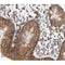 Cytochrome c Antibody for IHC in human colorectal tissue