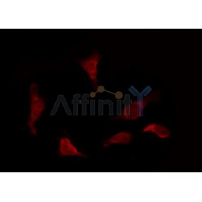 AF0146 staining COS7 by IF/ICC. The sample were fixed with PFA and permeabilized in 0.1% Triton X-100,then blocked in 10% serum for 45 minutes at 25¡ãC. The primary antibody was diluted at 1/200 and incubated with the sample for 1 hour at 37¡ãC. An  Alexa Fluor 594 conjugated goat anti-rabbit IgG (H+L) Ab, diluted at 1/600, was used as the secondary antibod