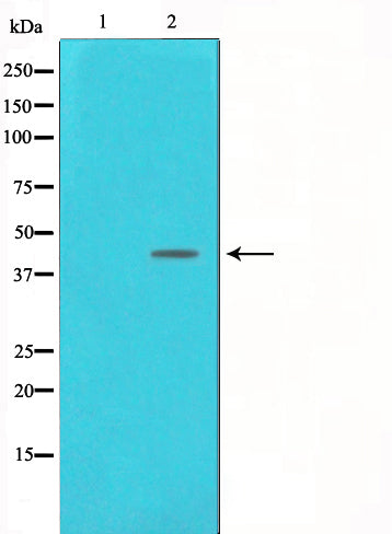 Western blot analysis on NIH-3T3 cell lysate using DNA Polymerase beta Antibody,The lane on the left is treated with the antigen-specific peptide.