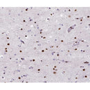 AF0148 at 1/200 staining human brain tissue sections by IHC-P. The tissue was formaldehyde fixed and a heat mediated antigen retrieval step in citrate buffer was performed. The tissue was then blocked and incubated with the antibody for 1.5 hours at 22¡ãC. An HRP conjugated goat anti-rabbit antibody was used as the secondary