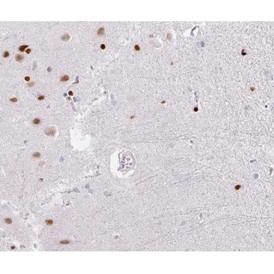 AF0149 at 1/100 staining human brain tissue sections by IHC-P. The tissue was formaldehyde fixed and a heat mediated antigen retrieval step in citrate buffer was performed. The tissue was then blocked and incubated with the antibody for 1.5 hours at 22¡ãC. An HRP conjugated goat anti-rabbit antibody was used as the secondary