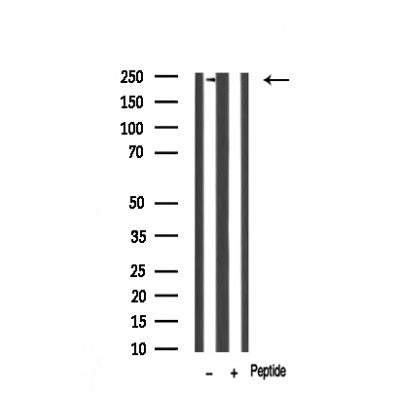 Western blot analysis of Dysferlin expression in Mouse brain lysate