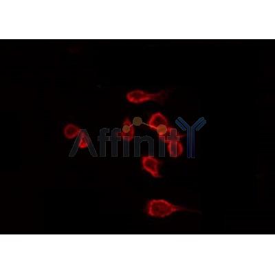AF0150 staining Hela by IF/ICC. The sample were fixed with PFA and permeabilized in 0.1% Triton X-100,then blocked in 10% serum for 45 minutes at 25¡ãC. The primary antibody was diluted at 1/200 and incubated with the sample for 1 hour at 37¡ãC. An  Alexa Fluor 594 conjugated goat anti-rabbit IgG (H+L) Ab, diluted at 1/600, was used as the secondary antibod