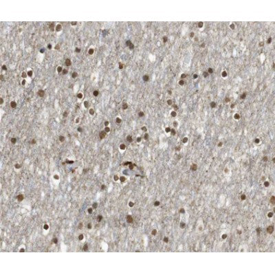 AF0151 at 1/100 staining human brain tissue sections by IHC-P. The tissue was formaldehyde fixed and a heat mediated antigen retrieval step in citrate buffer was performed. The tissue was then blocked and incubated with the antibody for 1.5 hours at 22¡ãC. An HRP conjugated goat anti-rabbit antibody was used as the secondary