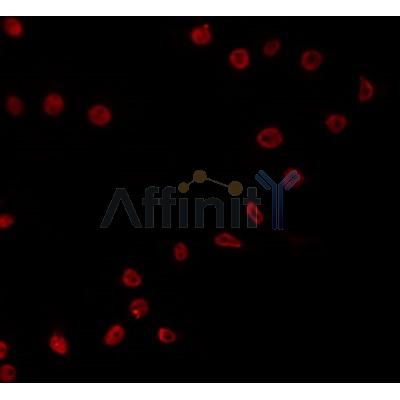 AF0151 staining COS7 by IF/ICC. The sample were fixed with PFA and permeabilized in 0.1% Triton X-100,then blocked in 10% serum for 45 minutes at 25¡ãC. The primary antibody was diluted at 1/200 and incubated with the sample for 1 hour at 37¡ãC. An  Alexa Fluor 594 conjugated goat anti-rabbit IgG (H+L) Ab, diluted at 1/600, was used as the secondary antibod
