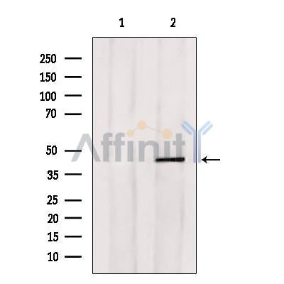 Western blot analysis of extracts from HepG2, using E2F4 Antibody. Lane 1 was treated with the blocking peptide.