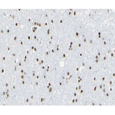 AF0152 at 1/100 staining human brain tissue sections by IHC-P. The tissue was formaldehyde fixed and a heat mediated antigen retrieval step in citrate buffer was performed. The tissue was then blocked and incubated with the antibody for 1.5 hours at 22¡ãC. An HRP conjugated goat anti-rabbit antibody was used as the secondary