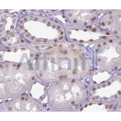 IHC analysis of mouse kidney tissue, using ERCC1 Antibody at 1:100.