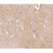 AF0156 at 1/100 staining human brain tissue sections by IHC-P. The tissue was formaldehyde fixed and a heat mediated antigen retrieval step in citrate buffer was performed. The tissue was then blocked and incubated with the antibody for 1.5 hours at 22¡ãC. An HRP conjugated goat anti-rabbit antibody was used as the secondary