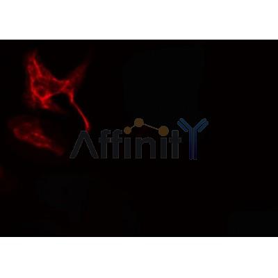 AF0156 staining HuvEc cells by IF/ICC. The sample were fixed with PFA and permeabilized in 0.1% Triton X-100,then blocked in 10% serum for 45 minutes at 25¡ãC. The primary antibody was diluted at 1/200 and incubated with the sample for 1 hour at 37¡ãC. An  Alexa Fluor 594 conjugated goat anti-rabbit IgG (H+L) antibody(Cat.