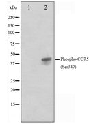 Western blot analysis on Jurkat cell lysate using Phospho-CCR5(Ser349) Antibody.The lane on the left is treated with the antigen-specific peptide.