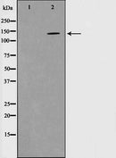 Western blot analysis on mouse brain cell lysate using Phospho-PYK2(Tyr580) Antibody.The lane on the left is treated with the antigen-specific peptide.
