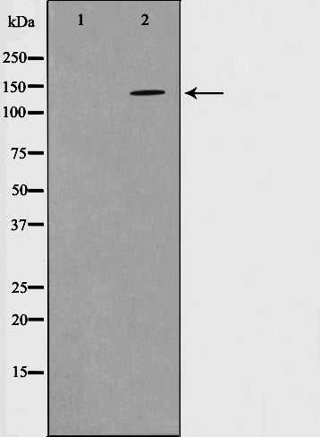 Western blot analysis on mouse brain cell lysate using Phospho-PYK2(Tyr580) Antibody.The lane on the left is treated with the antigen-specific peptide.